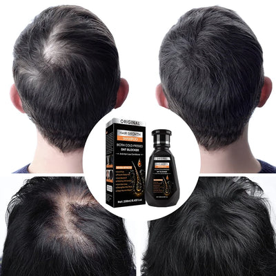 Original Biotin Cold-Pressed DHT BLOCKER Hair Growth Shampoo Formbo- 250ML