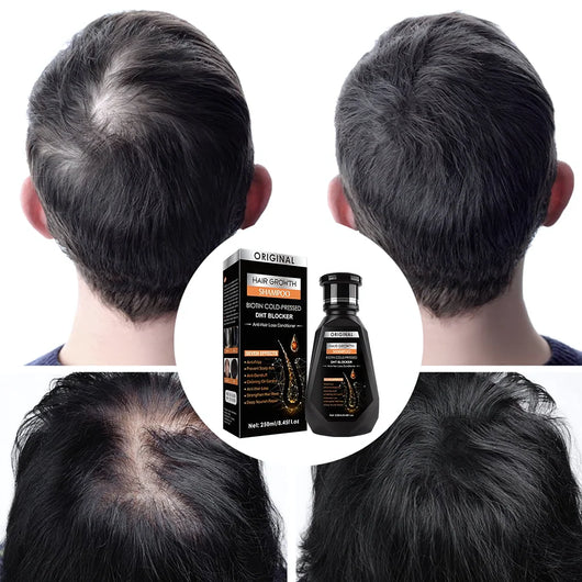 Original Biotin Cold-Pressed DHT BLOCKER Hair Growth Shampoo Formbo- 250ML