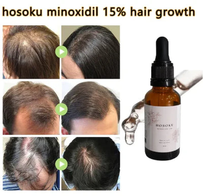 HOSOKU Minoxidil 15% Hair Regrowth Oil – 30ml