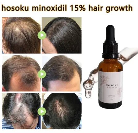 HOSOKU Minoxidil 15% Hair Regrowth Oil – 30ml