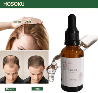 HOSOKU Minoxidil 15% Hair Regrowth Oil – 30ml