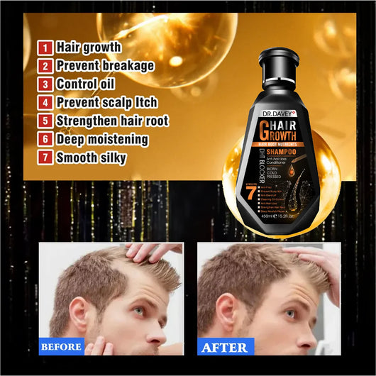 Dr. Davey Hair Growth Shampoo – 450ml