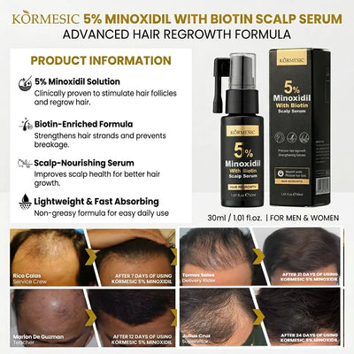 KORMESIC 5% Minoxidil with Biotin Scalp Serum – 30ml