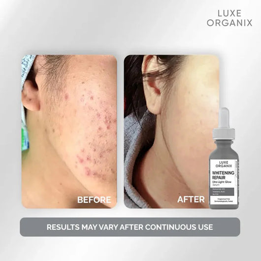 Luxe Organix Whitening Repair Ultra Light Glow Serum – 30ml